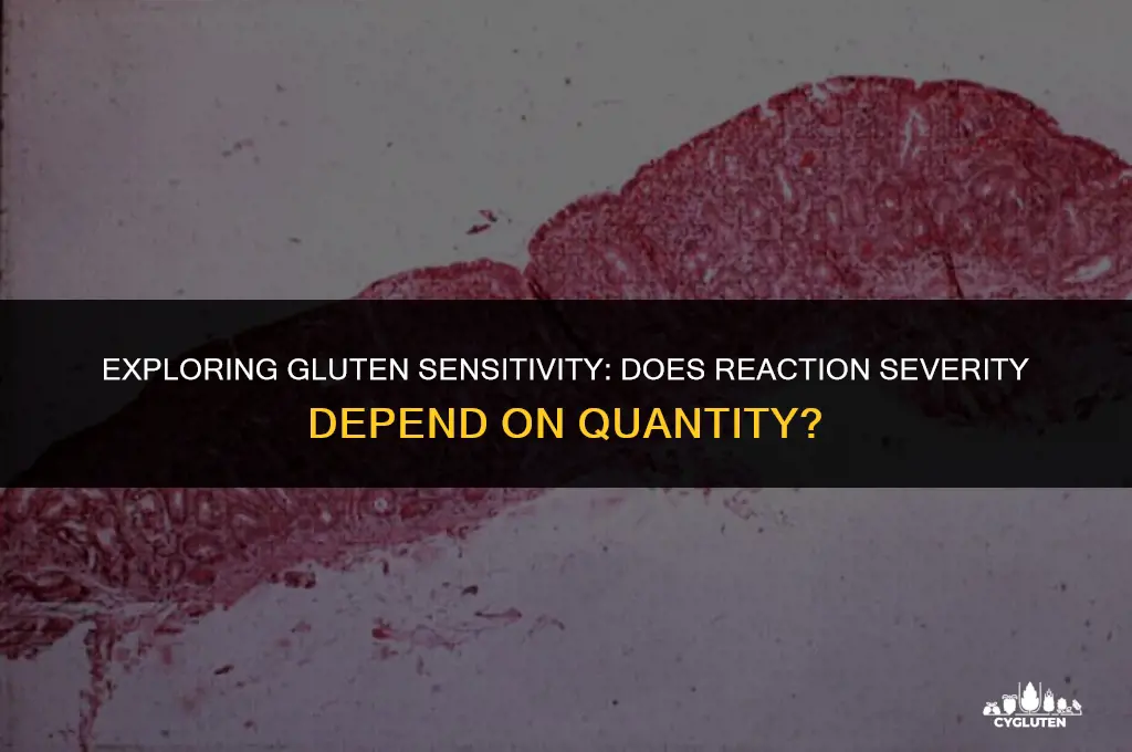 does severity of gluten reaction depend on quantity ingested
