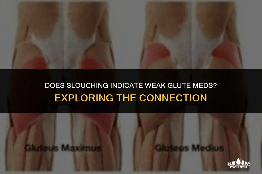 does slouching indicate a weak glute med