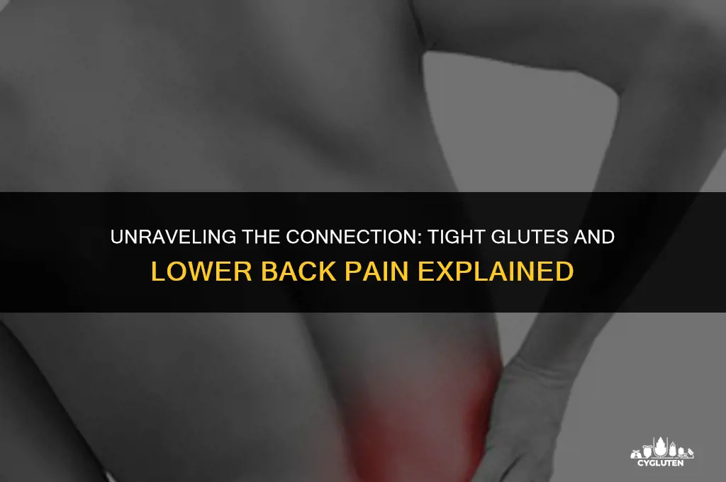 does tight glutes cause lower back pain