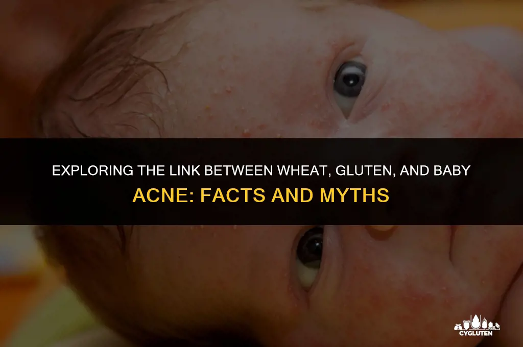 does to much wheat or gluten cause baby acne