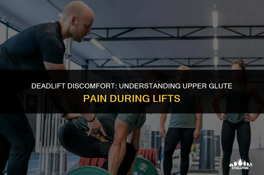 does your upper glutes hurt while deadlift