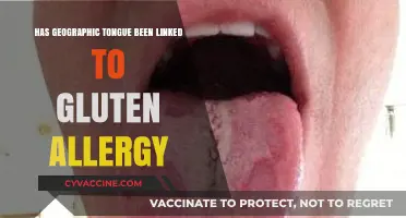 Exploring the Connection: Geographic Tongue and Gluten Allergy
