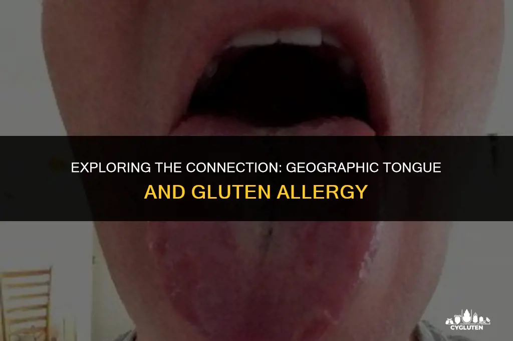 has geographic tongue been linked to gluten allergy
