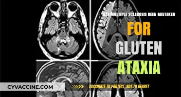 Unraveling the Mystery: Multiple Sclerosis vs. Gluten Ataxia Misdiagnosis