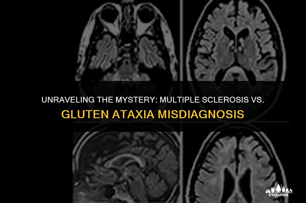 has multiple sclerosis been mistaken for gluten ataxia