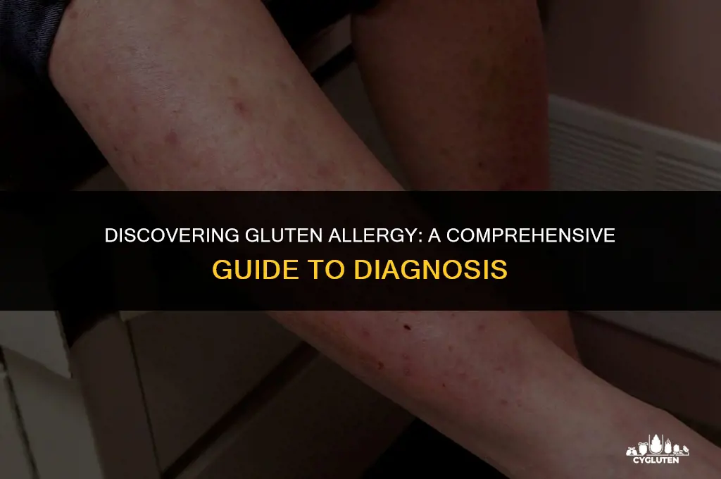 how do i find out if im allergic to gluten