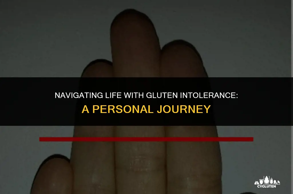 how do you feel if you are gluten intolerant