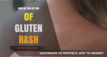 Gluten Rash Relief: A Comprehensive Guide to Soothing Your Skin