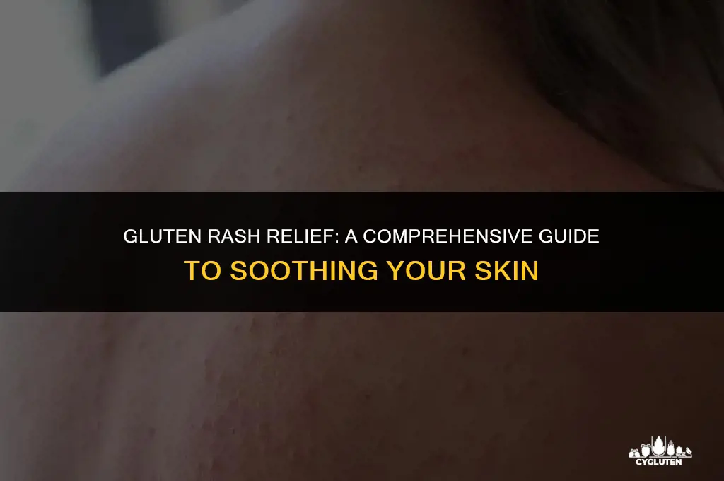 how do you get rid of gluten rash