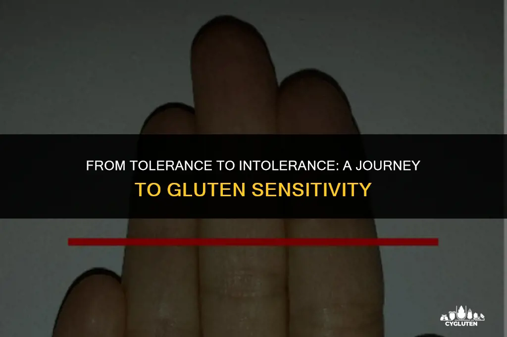 how do you one day become gluten intolerant