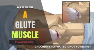 Understanding Glute Muscle Tears: Causes, Symptoms, and Recovery