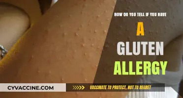 Unraveling the Mystery: Signs You Might Have a Gluten Allergy
