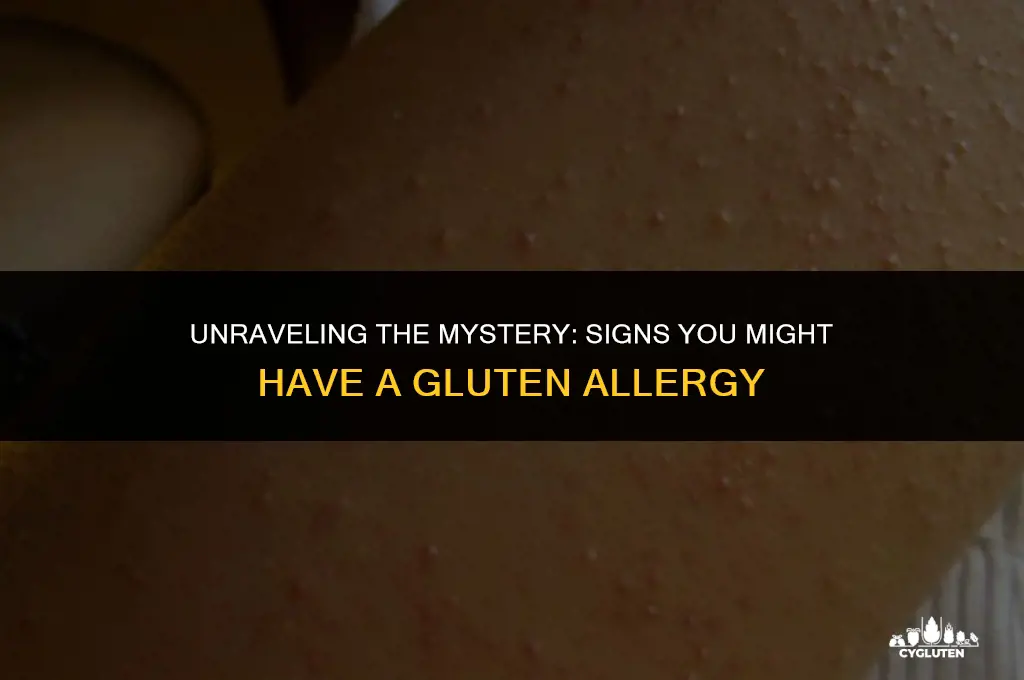 how do you tell if you have a gluten allergy