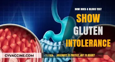 Unveiling Gluten Intolerance: The Insights from a Blood Test