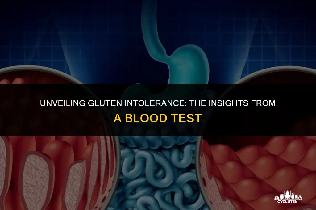 how does a blood test show gluten intolerance