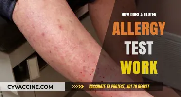 Unraveling the Mystery: How Gluten Allergy Tests Work