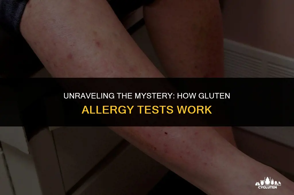 how does a gluten allergy test work
