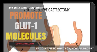 Gastric Sleeve Surgery: Unlocking the Power of GLUT-1 Molecules
