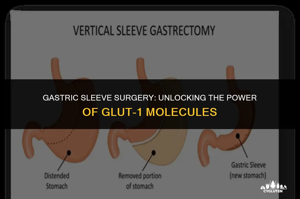 how does gastric sleeve surgery promote glut-1 molecules