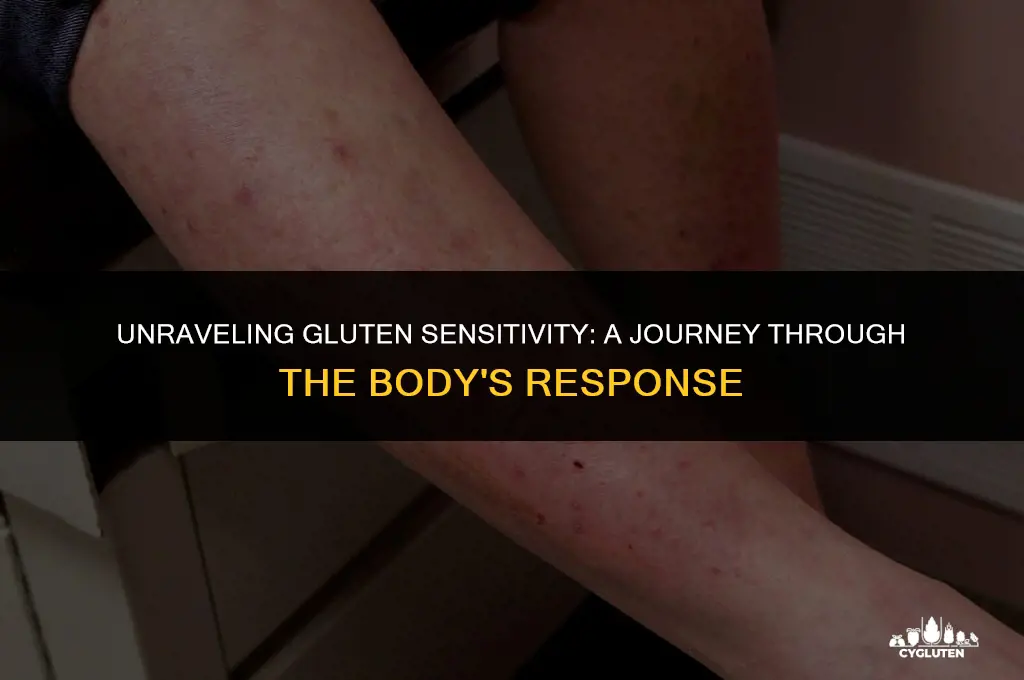 how does gluten and sensitivity work in the body