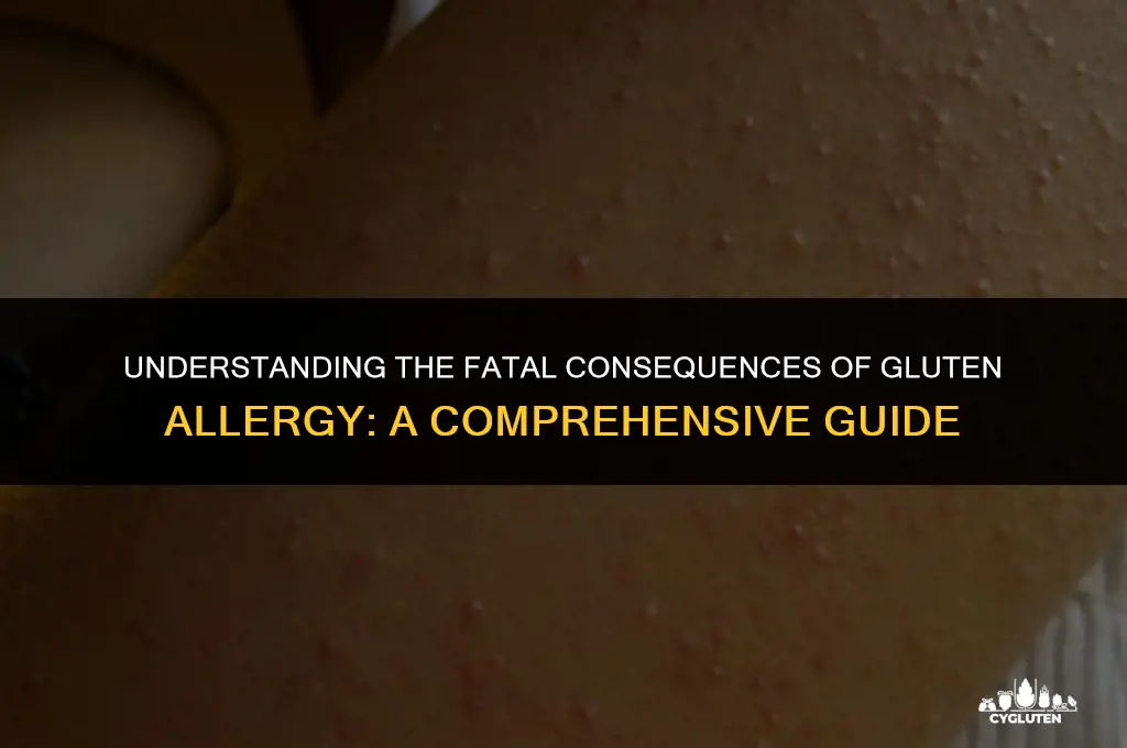 how does one die from gluten allergy