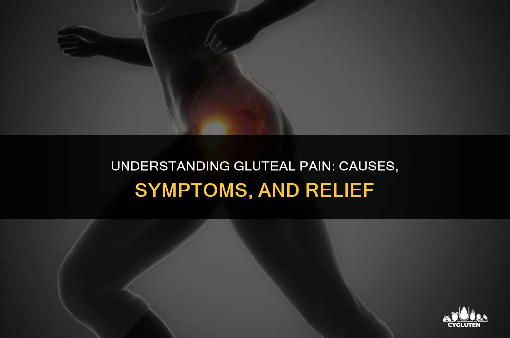 how does pain in glutes present itseld