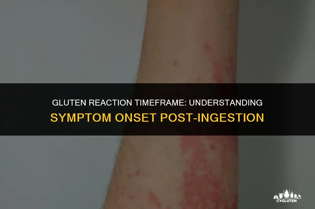 how fast after eating gluten do symptoms appear
