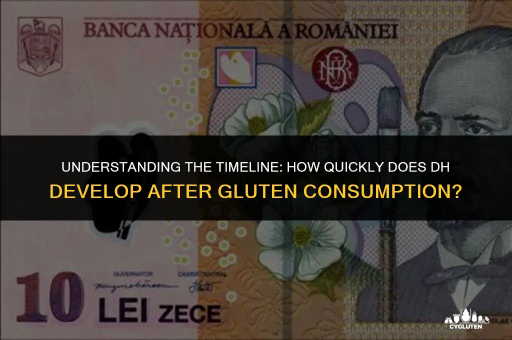 how fast do you develop dh after eating gluten