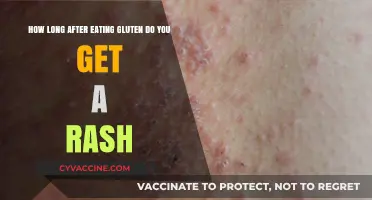Gluten Rash Timeline: When Does Skin React After Consumption?