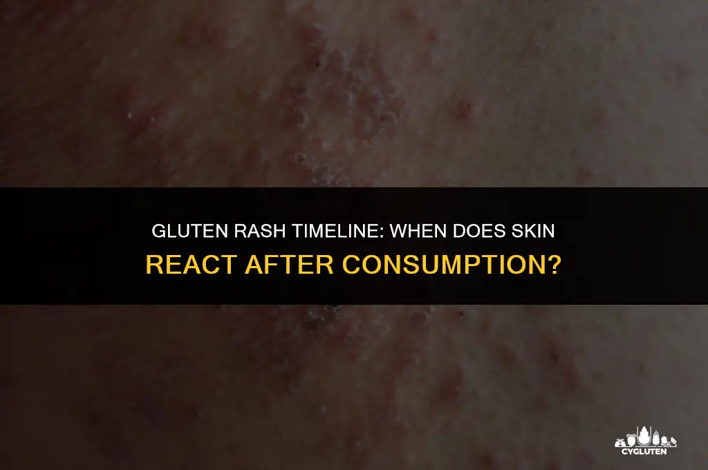 how long after eating gluten do you get a rash