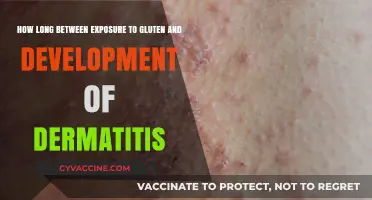 Understanding the Timeline: Gluten Exposure to Dermatitis Development