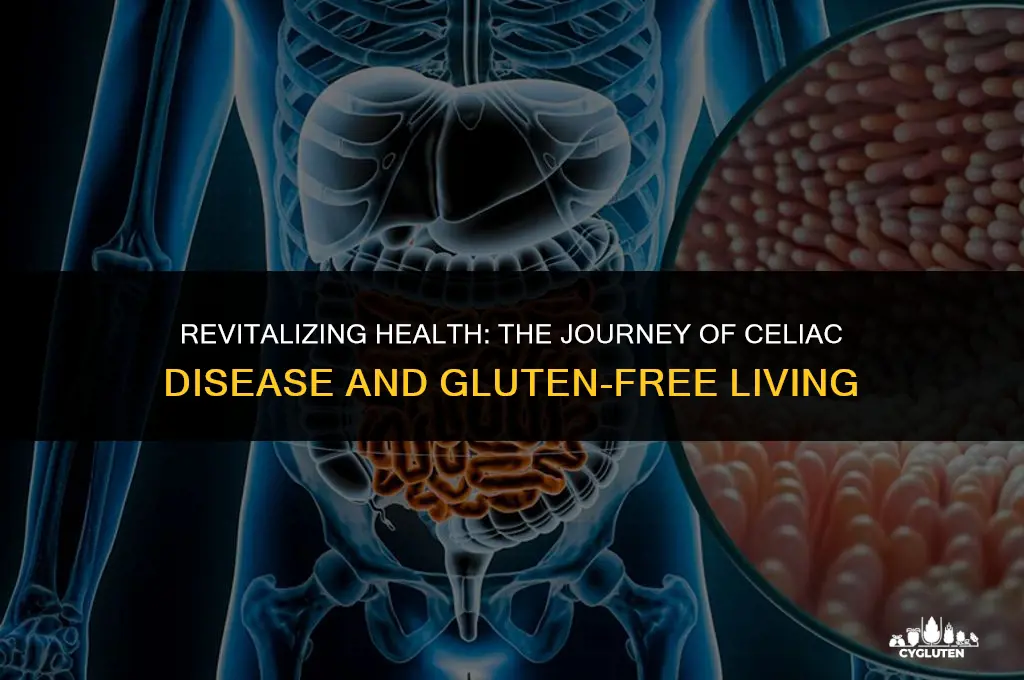how long celiac disease gluten fee improves