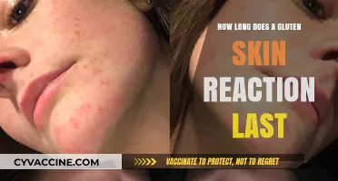 Understanding Gluten Skin Reactions: Duration and Management Tips
