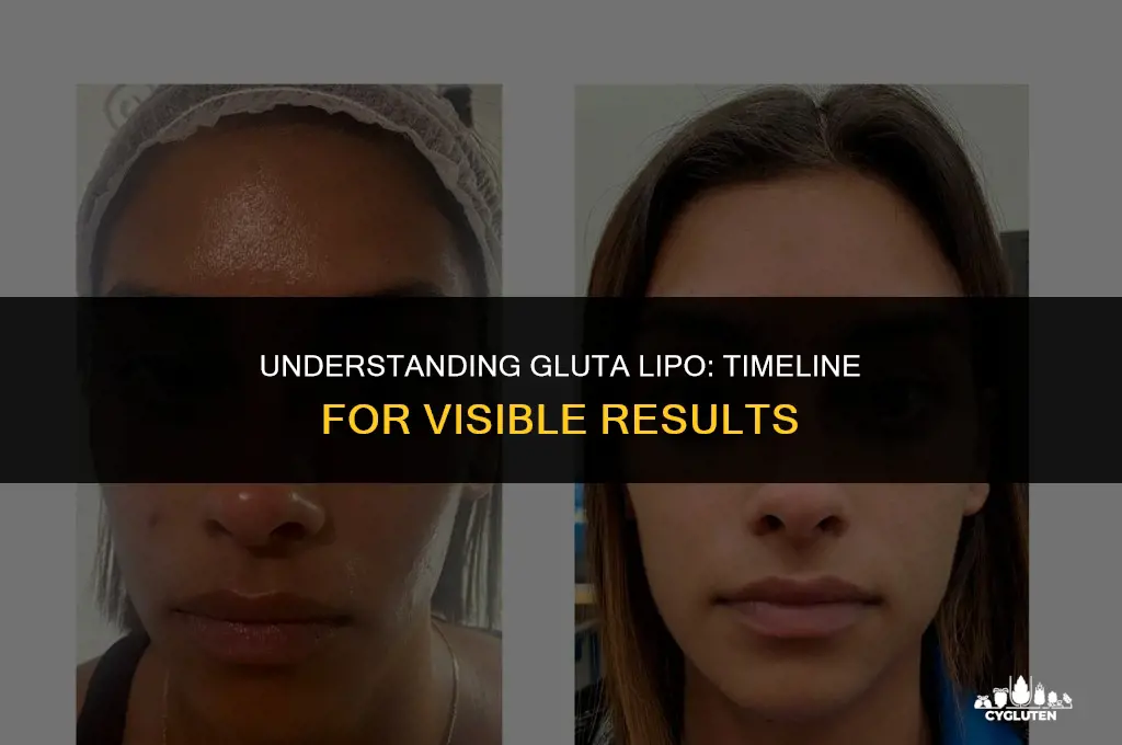 how long does gluta lipo take effect