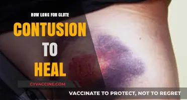 Glute Contusion Recovery Timeline: What to Expect and How to Heal
