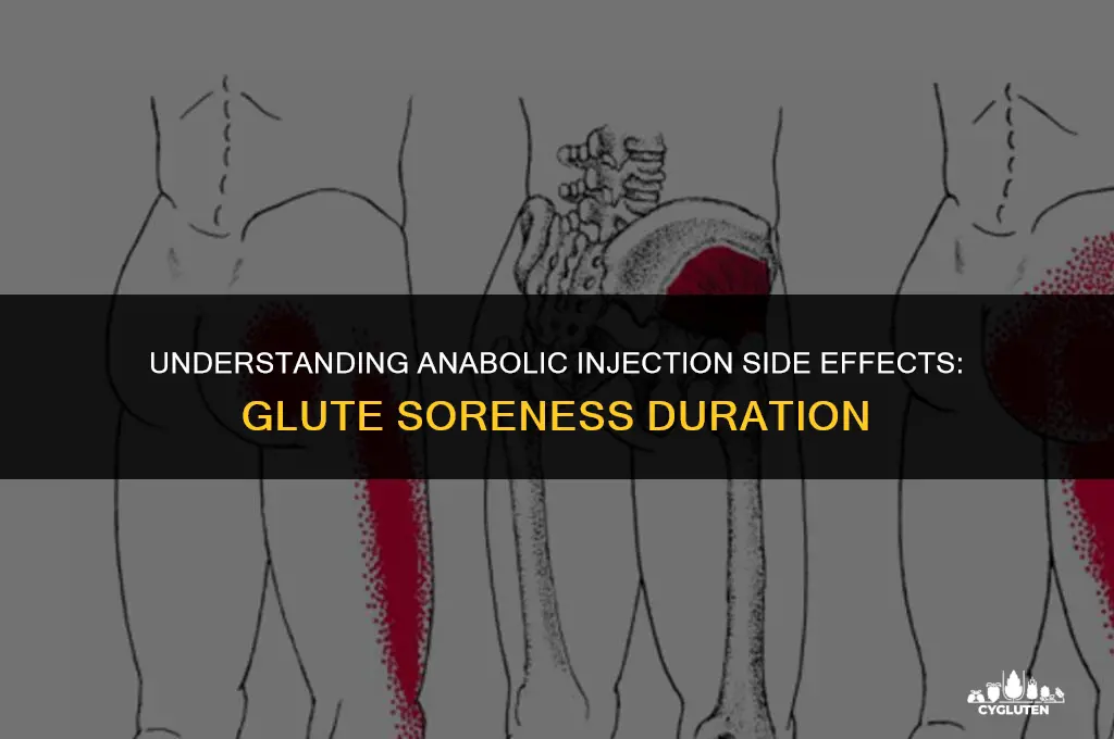 how long is my glute sore from anabolic injection
