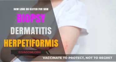 Understanding Gluten Exposure for Skin Biopsy in Dermatitis Herpetiformis