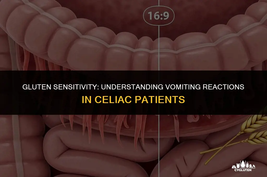 how many celiacs disease patients vomit if they eat gluten