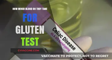 Understanding Gluten Testing: A Guide to Blood Sample Requirements