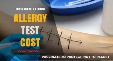 Unveiling the Cost of Gluten Allergy Testing: A Comprehensive Guide