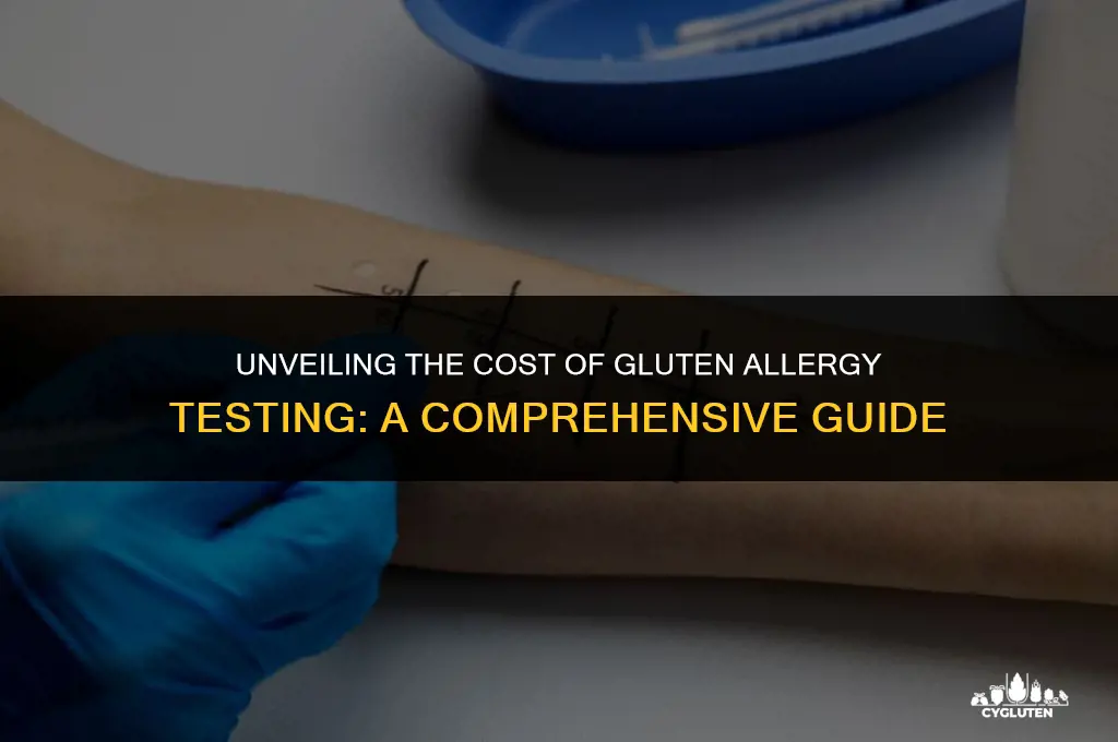 how much does a gluten allergy test cost
