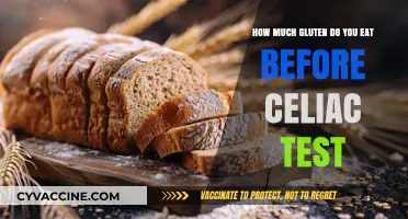 Gluten Consumption Guidelines: What to Know Before a Celiac Test