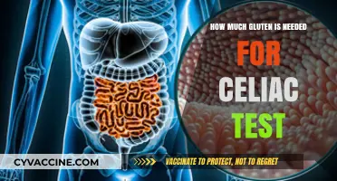 Understanding Gluten Thresholds: A Guide to Celiac Testing