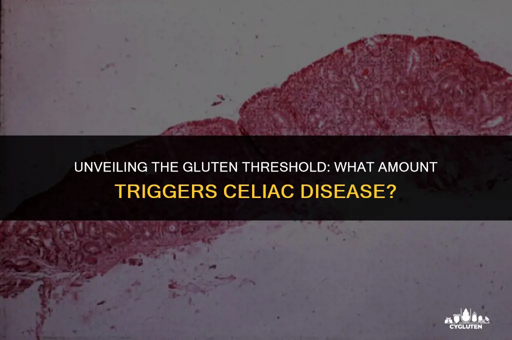 how much gluten to activate celiac disease