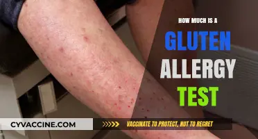 Unveiling the Cost: Gluten Allergy Testing Explained