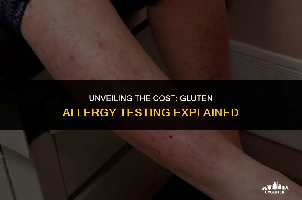 how much is a gluten allergy test