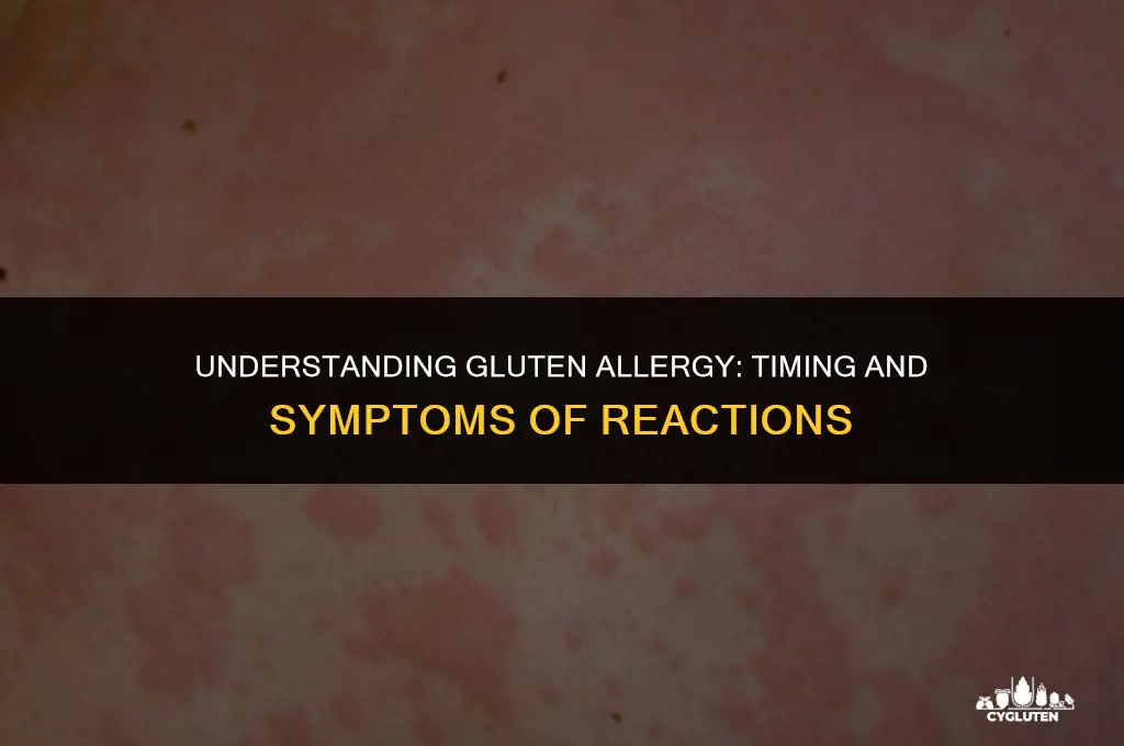 how quickly do you have an allergic reaction to gluten