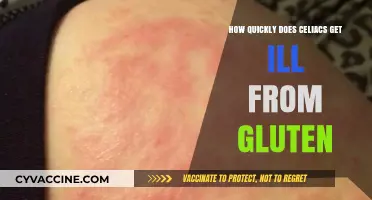 Gluten Reaction Time: How Soon Do Celiacs Feel Symptoms?