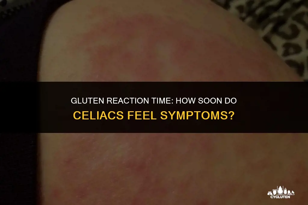 how quickly does celiacs get ill from gluten