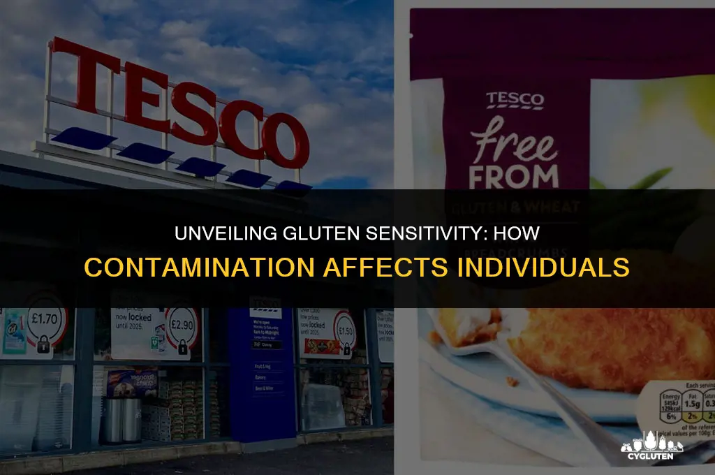how sensitive re people to gluten contamination